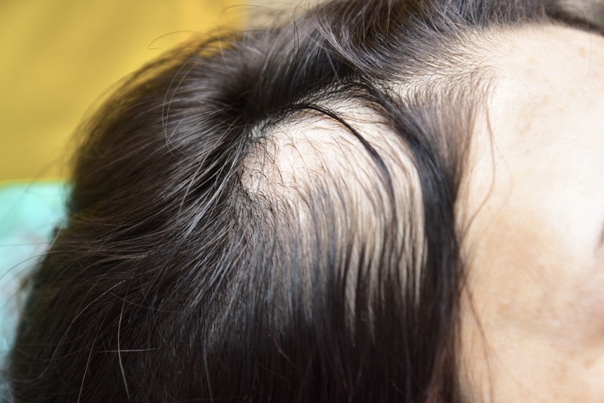 placeholder image-sq